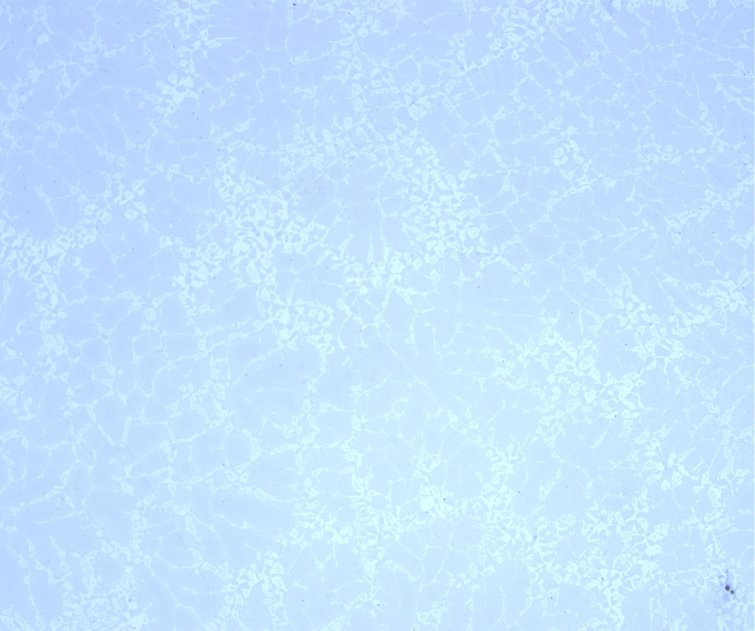 200X.jpg
